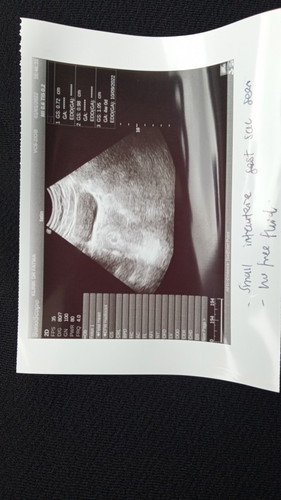Bahaya ke ikt tarikh pregnant 7weeks pergi scan dokter bg tau 4weeks?