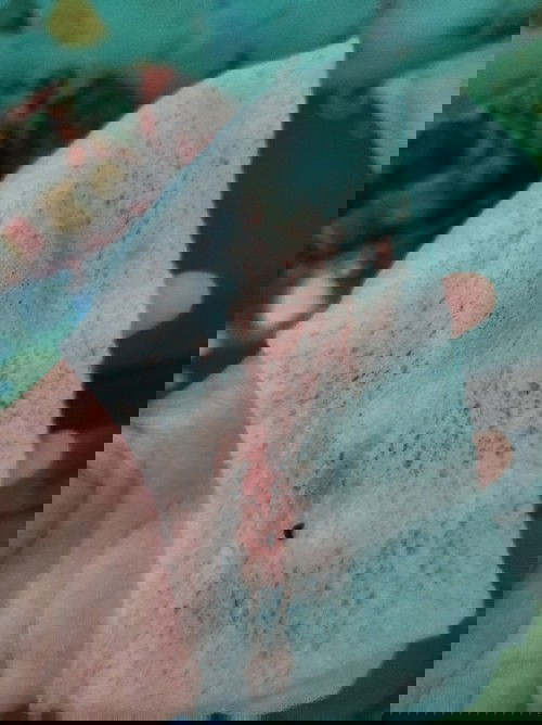 Pa help Naman po . Ask ko lng po kung normal lng po ba Ang vaginal spotting sa 26weeks na buntis .