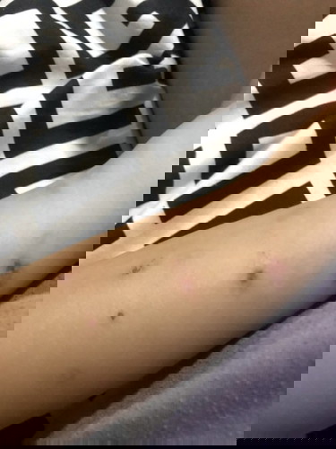 Sensitive Skin