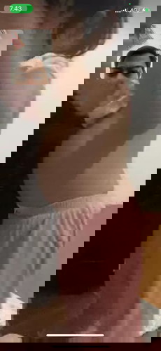 Anak saya umur 1,5 tahun perutnyq buncit saya agak hawatir apakah ini normal?