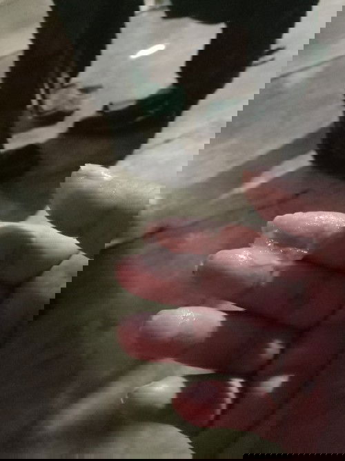 ท้องแก่มีมูกใส