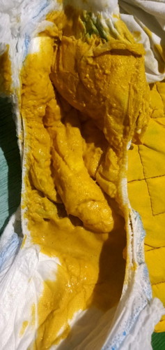 Pasintabi po sa kumakain
Mga mommys Ask ko lang to poop ng baby ko