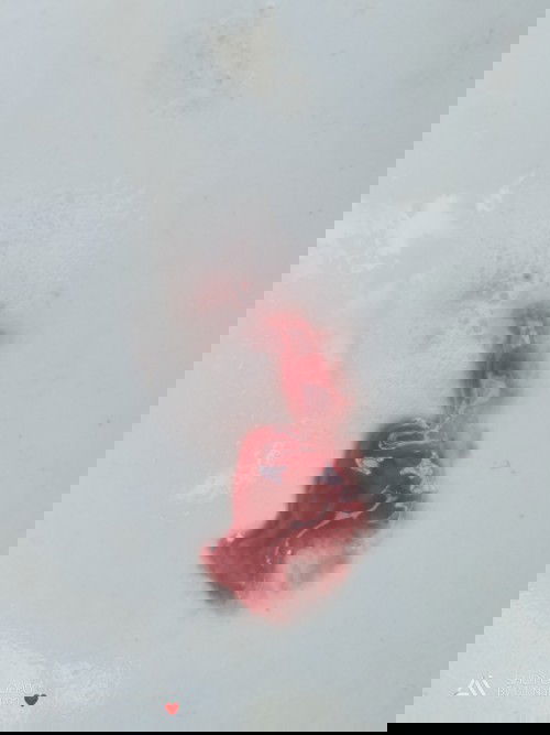 ก่อนจะมีก้อนเลือดออกมา ปวดท้องมากค่ะ แล้วก้อเปนอย่างในภาพ  คืออะไรคะ แม่ๆ