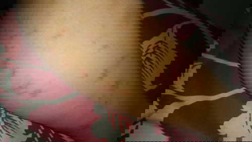 ada yg sama nggk bund dengan yg aku alamin