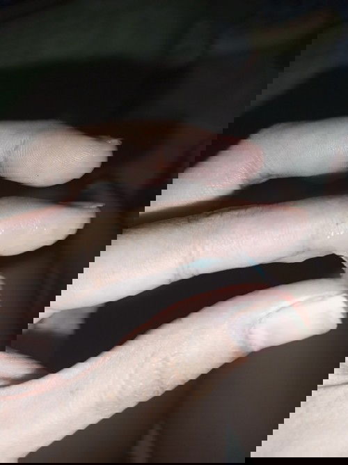 Hamil 35minggu dengan riwayat sc