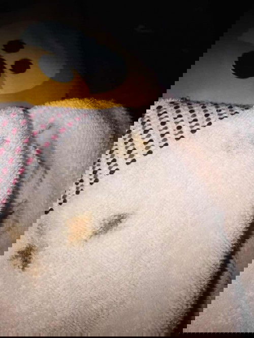 กระตุ้นปากมดลูก