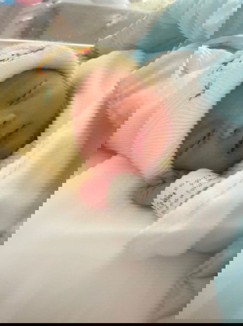 แตกแล้วคับ 1 มกราคม65 38w2d น้องต้นกล้า ดช.ภาคิน วรรณบวร น้ำหนัก2955 คลอด 08.00 น.