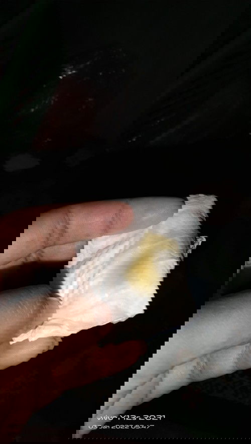 Tdi pgi keluar lendir kaya gitu39wek apa tanda mu lahiran? skrang pinggul sakit tapi perut blm sakit