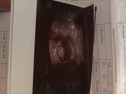 เสียน้องไปแล้ว