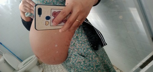 Các m cho e hỏi e 36tuan 1 ngày bụng như thế này đã tụt nhiều chưa ạ