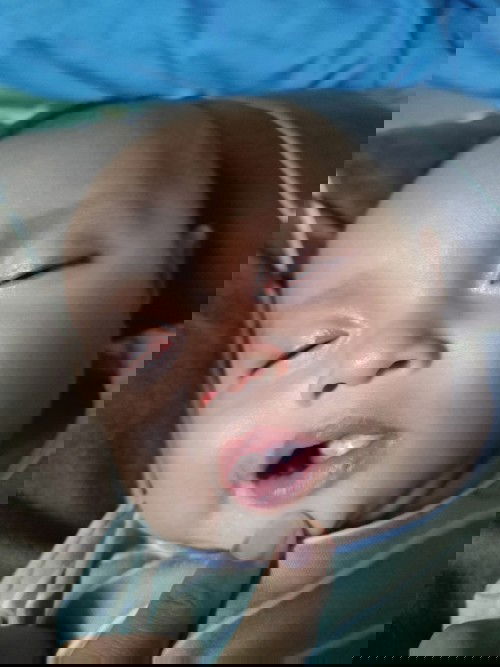 Diare pada bayi 3 bulan