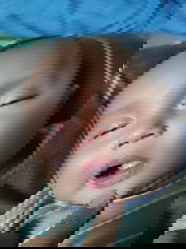 Diare pada bayi 3 bulan