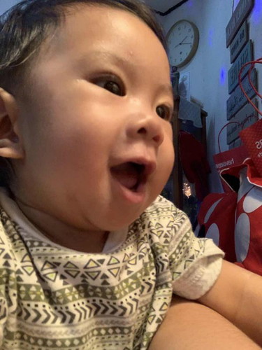 Solid food/recipe suggestion for baby’s 5months old with g6pd