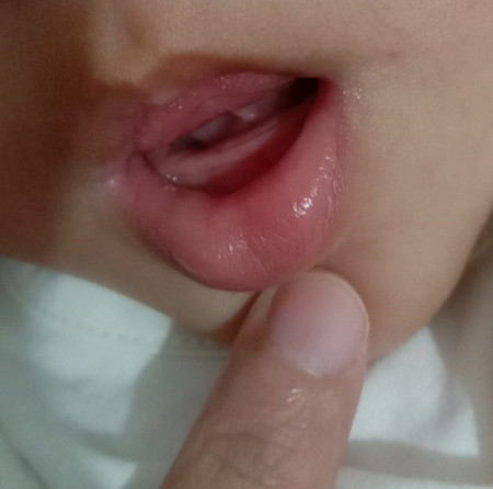 Mau tumbuh gigi bukan?