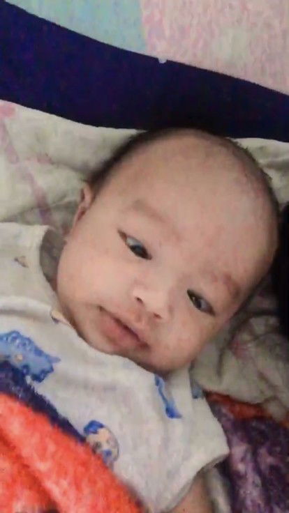 ลูกชอบทำตาเหลือก