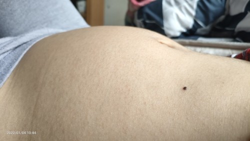 6เดือนแล้วแม่ๆบ้านไหนท้องเล็กบ้างค่ะกังวลมากค่ะกลัวลูกตัวเล็ก