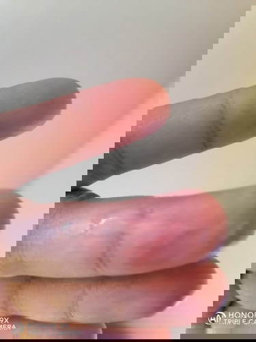 𝑳𝒆𝒏𝒅𝒊𝒓