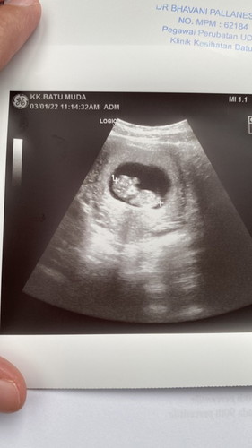 Journey of 10 weeks
