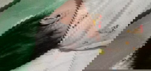 หัวแบนหัวเบี้ยว