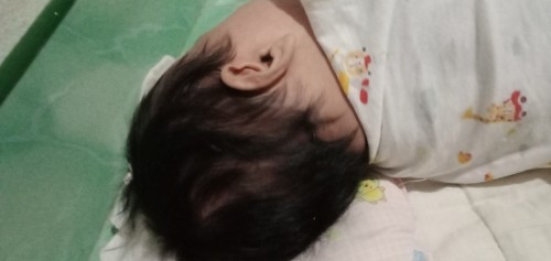 หัวแบนหัวเบี้ยว