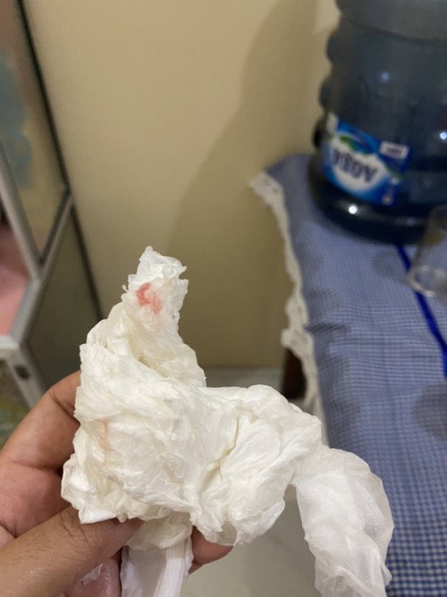 Tanda melahirkan sudah dekat?