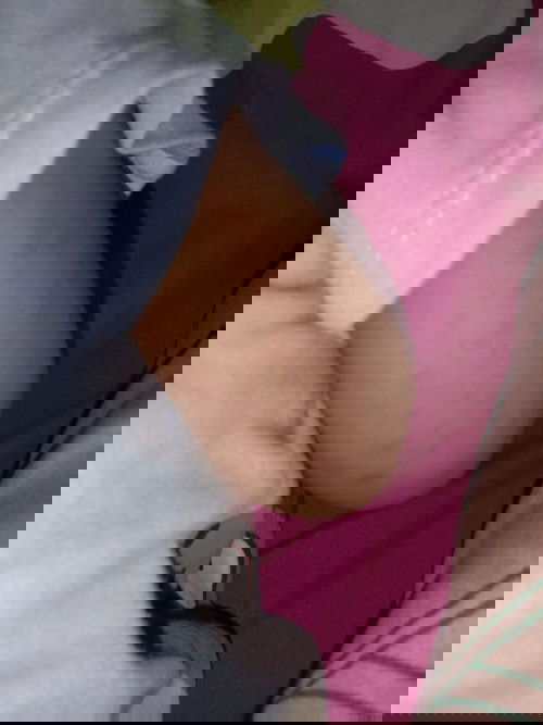 mengatasi ruam pada anak usia 8bulan