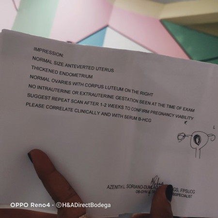 POSSITIVE SA PT PERO WALANG LAMAN NUNG TININGNAN SA ULTRASOUND