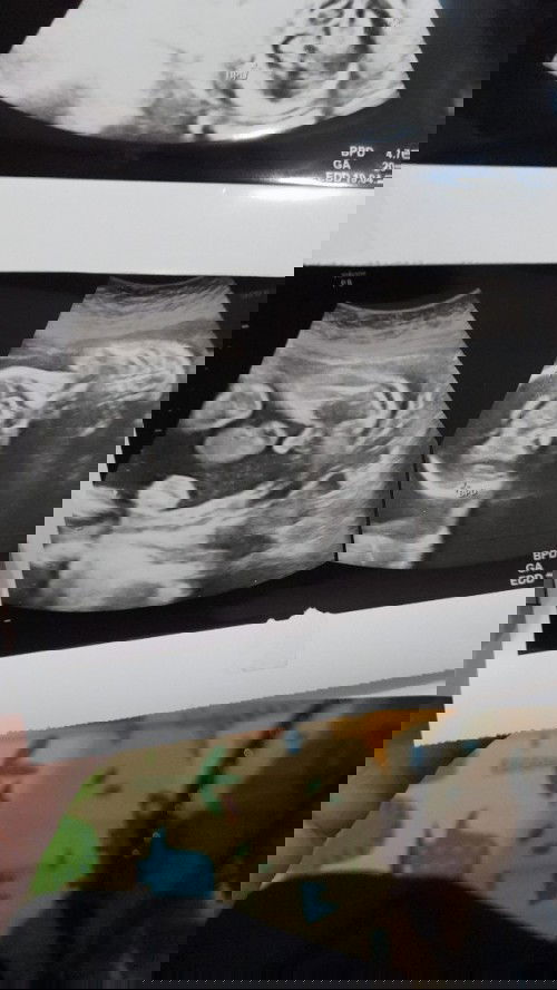 20w prediksi JK cewe, 24w prediksi JK cowo