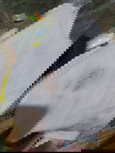 Puser Newborn berdarah