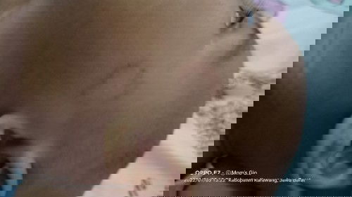 Kulit wajah gatal gatal