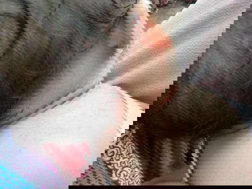 Bintik bintik merah di leher