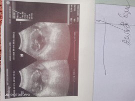 Usg di usia kandungan 13w4d