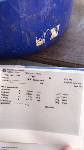 แม่ๆใหนดูน้ำหนักลูกตอนซาวเป็นบ้างค่ะ