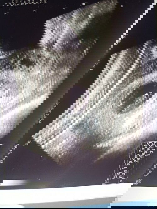 กังวลซาวด์ไม่เจอเสียงหัวใจน้องเต้น