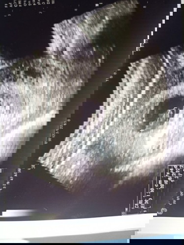 กังวลซาวด์ไม่เจอเสียงหัวใจน้องเต้น