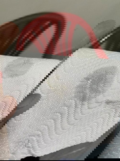 แบบนี้ใช่มูกใสมั้ยค่ะ