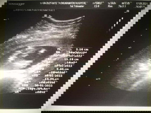 ผู้หญิงหรือผู้ชายค่ะเเม่ๆ