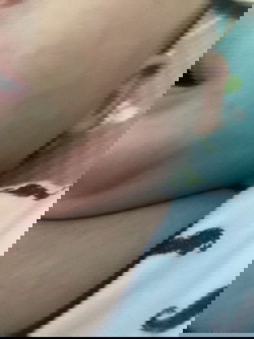 Các mom cho e hỏi bé bị s v ạ
Lúc chiều ít giờ nó lan rộng ra