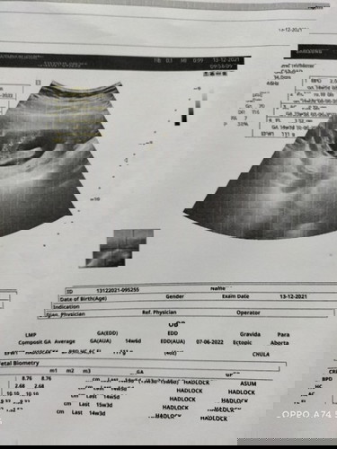 น้องเป็นผญ.หรือผช.คะ