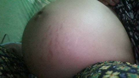 ท้องเเบบนี้ผู้หญิงหรือผู้ชายคะ31+1ค่ะเเล้วท้องเล็กไปไหมคะ💖