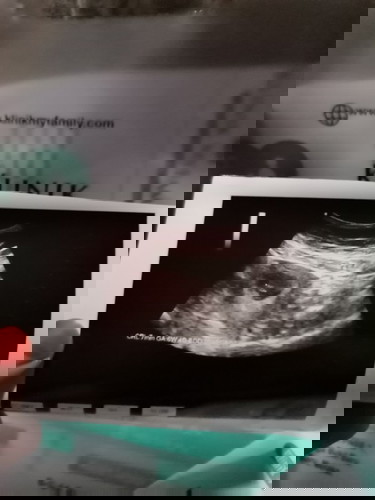 Pattnya 7week tapi doc ckap baru 6week3day, normal ke heartbeat tak nmpk lagi? 2mgu lgi jmpe doc.