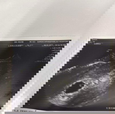 สอบถามแม่ๆหน่อยค่ะ