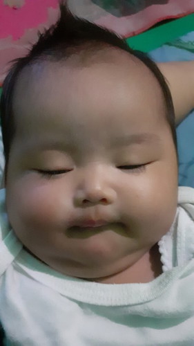 Bayi flu batuk berdahak