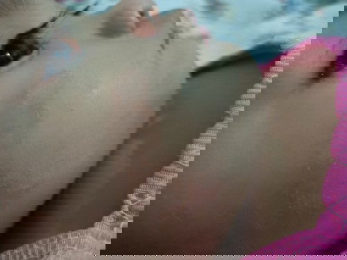 Ano po kaya tong tumubong rashes sa face ng baby ko?