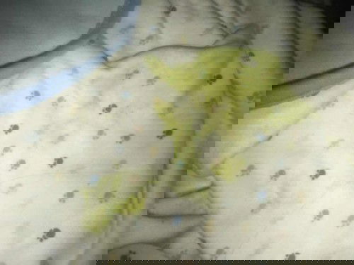 Light green na suka (vomit) and diarrhea.