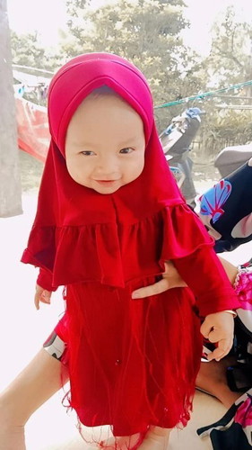 Bun anak usia 8 bulan kalau duduk sama berdiri kepalanya nunduk terus, paling sesekali tegak,