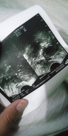 6weeks pero