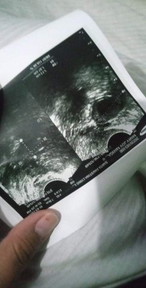6weeks pero