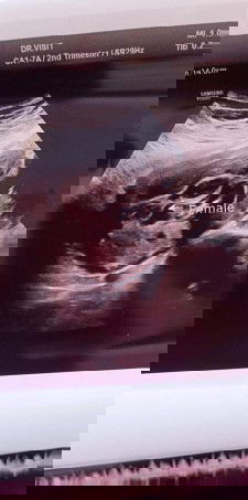 แม่ช่วยดูไห้หน่อยค่ะ ว่าหญิงหรือชาย