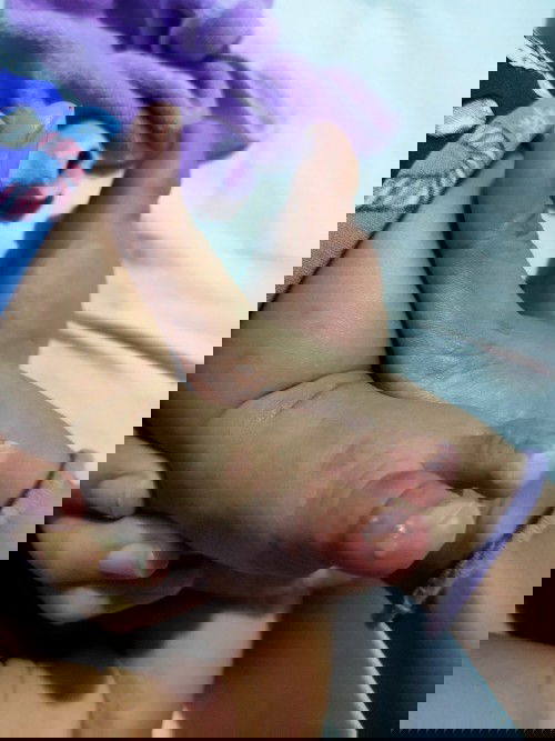 Paso paso nga ba ang tawag dito at paano mawala ang ganitong sakit?